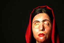 بانویی که با فاجعه رخ داده نتوانست او را از زندگی دل سرد کند +ویدیو 
