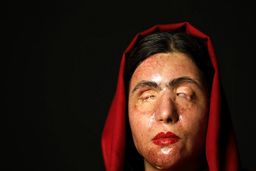 بانویی که با فاجعه رخ داده نتوانست او را از زندگی دل سرد کند +ویدیو 
