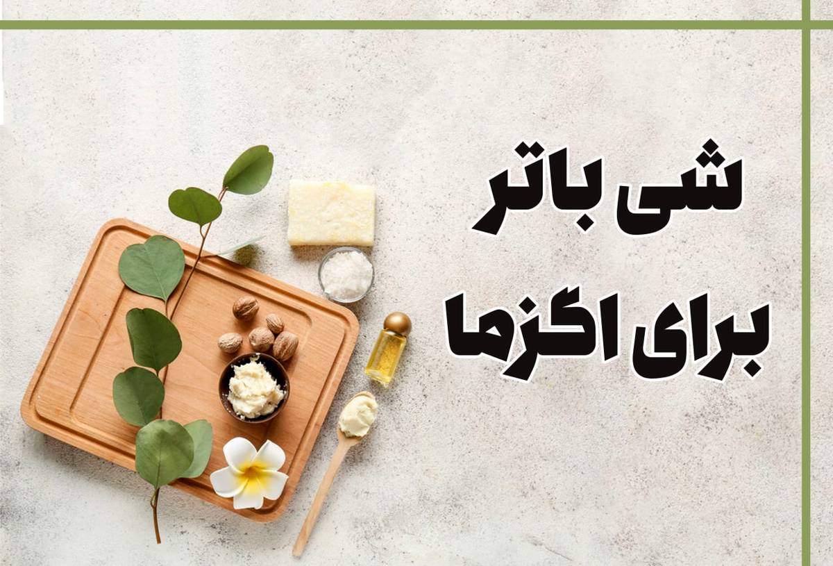 شی باتر برای اگزما مفید است؟ + طریقه مصرف
