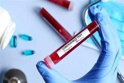 کرونا به پزشک باشگاه فوتبال هم رحم نکرد / او اولین قربانی لیگ جزیره است

