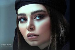 عکس ابراز علاقه ترک ها به سحر قریشی + چهره جدید سحر بعد از تزریق ژل