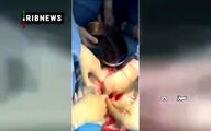 (ویدئو) عجیب از لحظه خروج ۳ کیلو پیچ و مهره از شکم یک بیمار