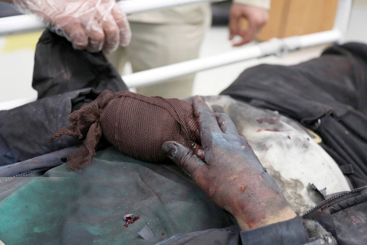 تصاویر جدید و ترسناک از مجروحان و فوتی های چهارشنبه سوری را ببینید 14+