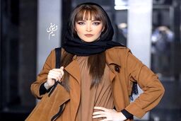 تغییر چهره باورنکردنی بهنوش طباطبایی بعد از عمل! + عکس های داغ 