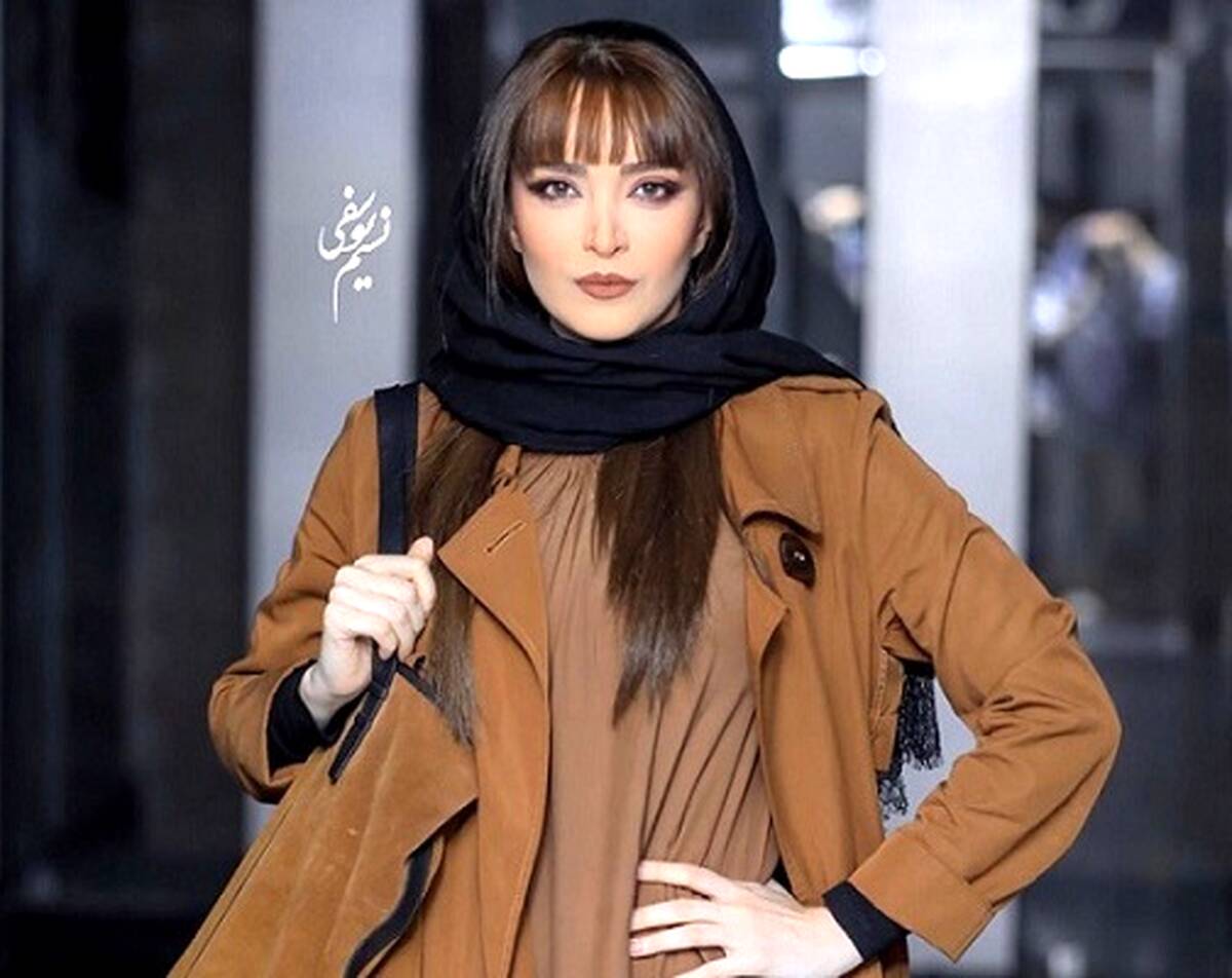 تغییر چهره باورنکردنی بهنوش طباطبایی بعد از عمل! + عکس های داغ 