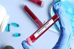 اولین کرونایی لیگ فوتبال امارات + عکس

