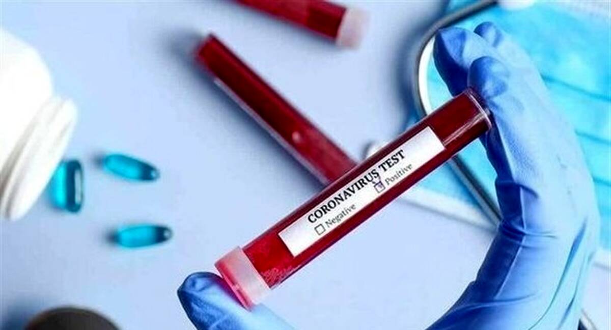 اولین کرونایی لیگ فوتبال امارات + عکس

