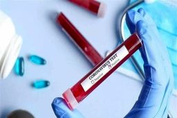 اولین کرونایی لیگ فوتبال امارات + عکس

