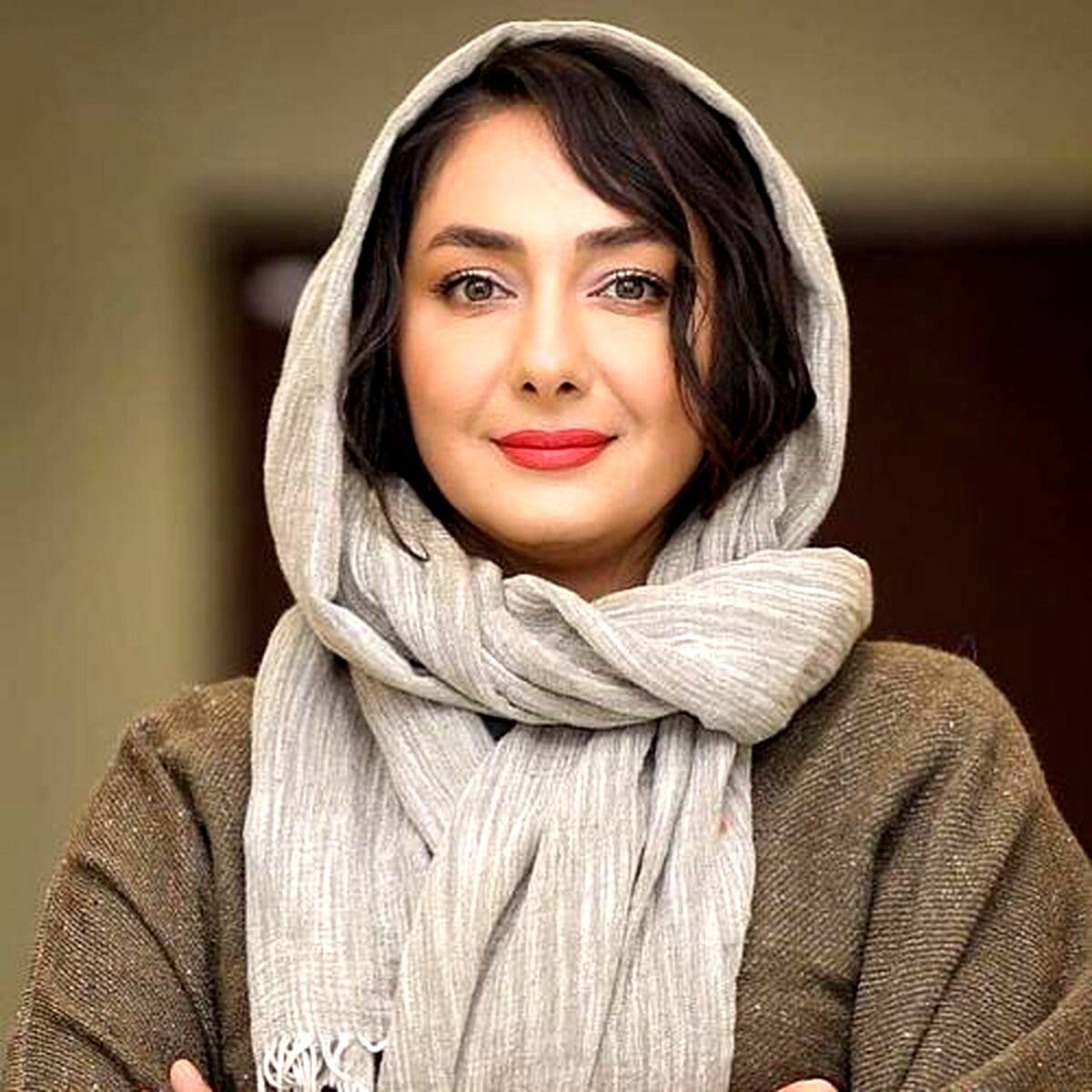 صورت مریض و جوش زده هانیه توسلی همه را غافلگیر کرد