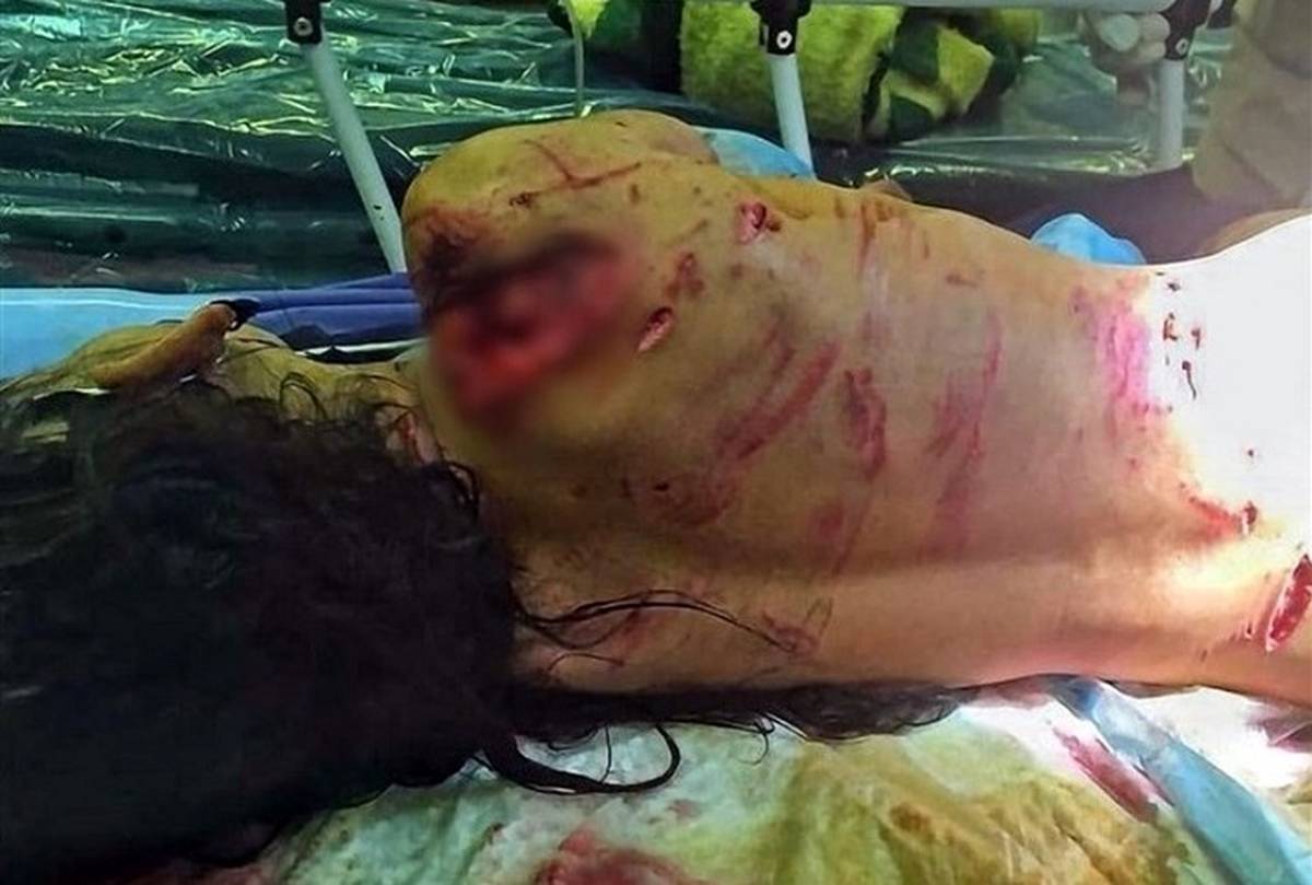 فیلم وحشتناک از حمله سگ های وحشی به دخترک بی نوا + فیلم حاوی صحنه های دلخراش است!