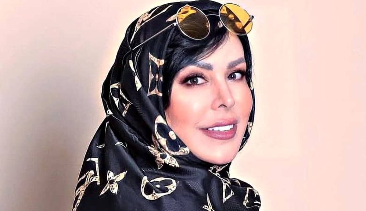 پوشش جدید فلور نظری در کافه های اروپا!فلور نظری بعد از عمل 20سال جوان شد|عکس