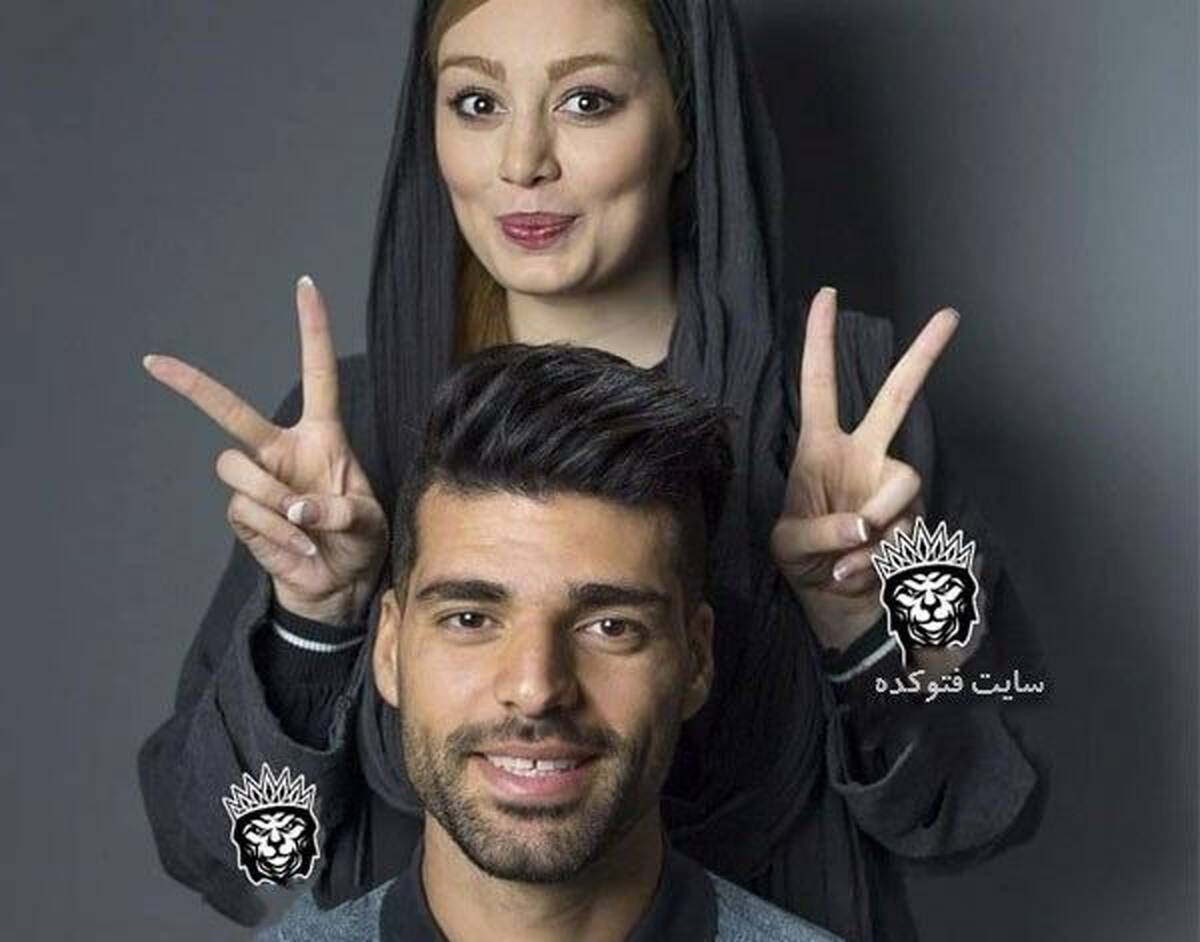 چهره غیرطبیعی سحر قریشی بعد از تزریق ژل | اینستاگرام سحر قریشی