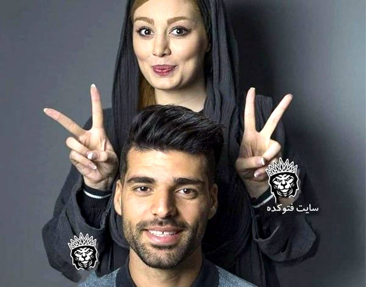 چهره غیرطبیعی سحر قریشی بعد از تزریق ژل | اینستاگرام سحر قریشی
