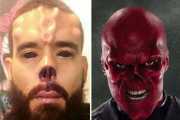 ترسناک ترین جراحی های دنیا + عکس های چندش آور 18+

