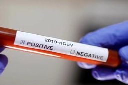 شناسایی افراد کرونا مثبت از طریق کارت ملی +جزئیات 

