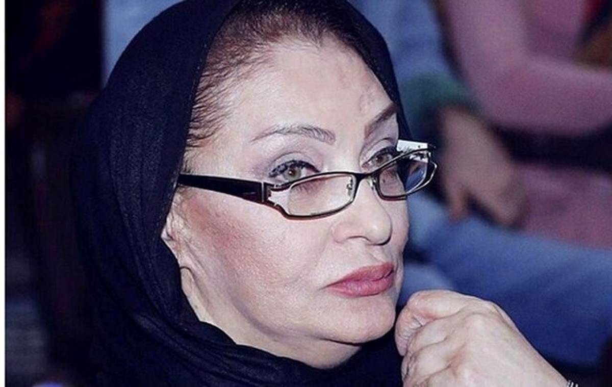 بازیگر زن مشهور سینمای ایران به کما رفت