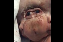 تولد نوزادی عجیب الخلقه در تهران + فیلم و عکس 16+


