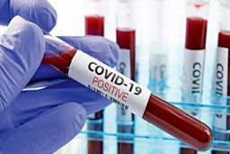 نحوه قرنطینه بیماران مشکوک کرونا در خانه+فیلم 
