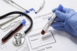 هزینه  تست‌ ۳۰دقیقه‌ای کرونا چقدر است؟