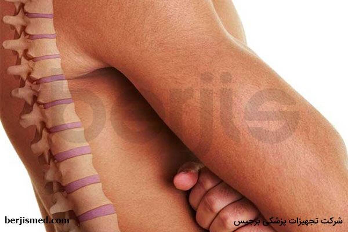 اثر تغذیه دیسک در پیدایش فرسایش کمر چیست؟