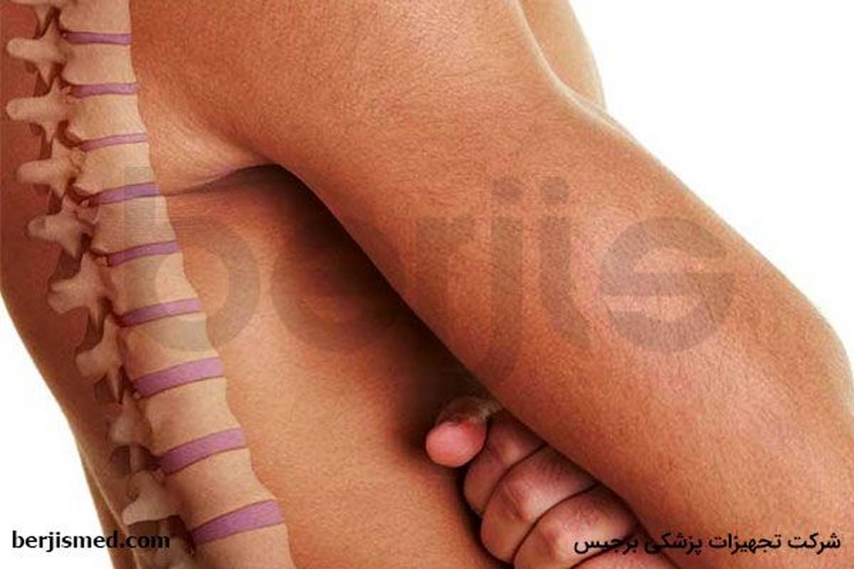 اثر تغذیه دیسک در پیدایش فرسایش کمر چیست؟