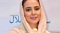 عکس باورنکردنی الناز حبیبی قبل از عمل زیبایی! +تصاویر جنجالی