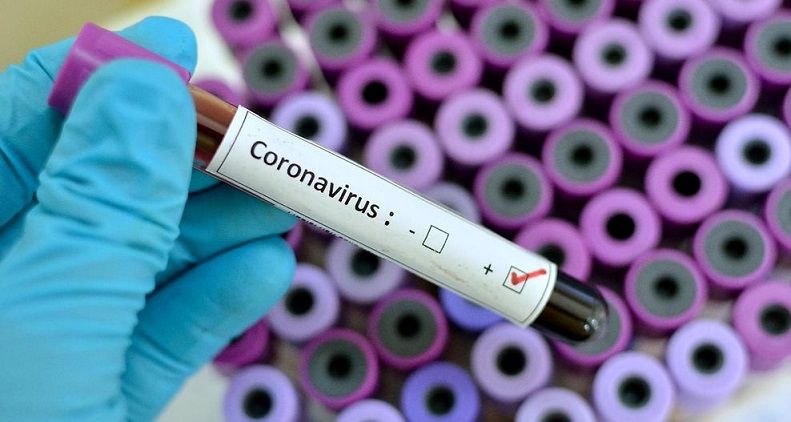 قیمت جدید تست کرونا اعلام شد؛مراقب کلاهبرداران باشید